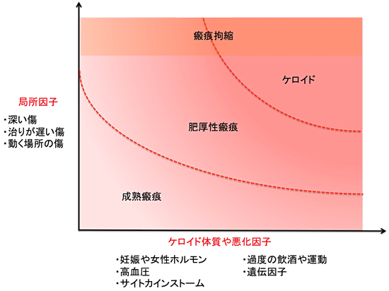 ステロイド サイトカイン ストーム 新型コロナウイルス感染症(COVID